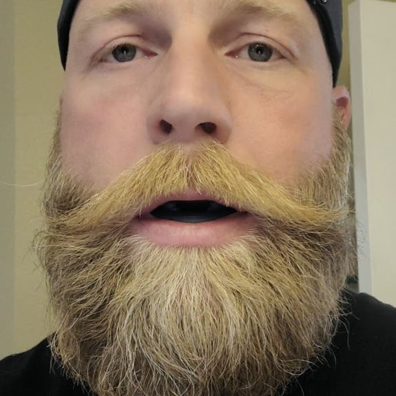 Vitalessent® Anti-Schnarchen